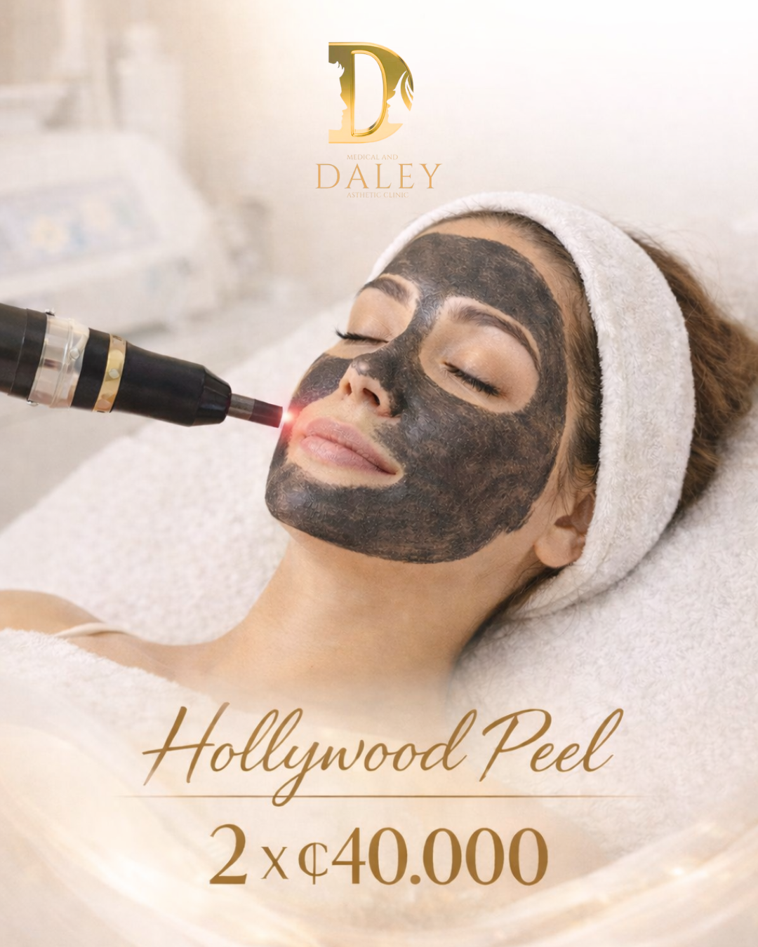 Hollywood Peel — 2x ₡40,000